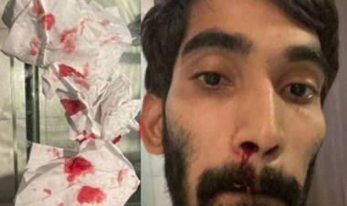 തുടരെ നാല് കൊവിഡ് ടെസ്റ്റ് : മൂക്കില്‍ നിന്ന് രക്തം വാര്‍ന്ന് ഇന്ത്യന്‍ ബാഡ്മിന്റണ്‍ താരം