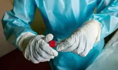 കോവിഡ്​ ആര്‍.ടി.പി.സി.ആര്‍ പരിശോധന നിരക്ക് 1700 രൂപയാക്കി