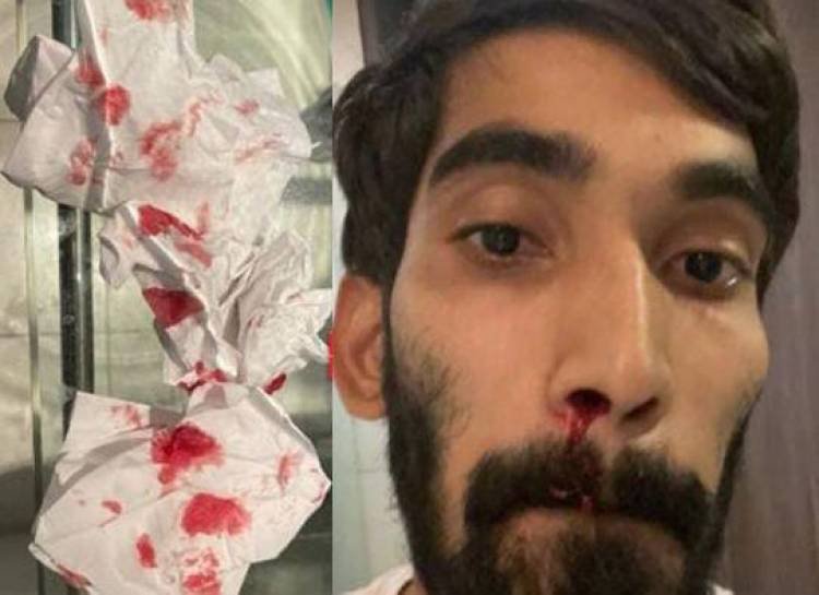 തുടരെ നാല് കൊവിഡ് ടെസ്റ്റ് : മൂക്കില്‍ നിന്ന് രക്തം വാര്‍ന്ന് ഇന്ത്യന്‍ ബാഡ്മിന്റണ്‍ താരം